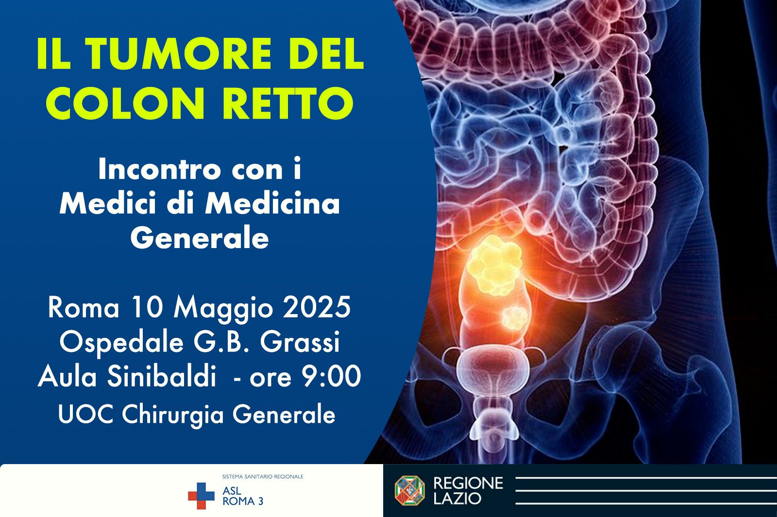 ASL Roma 3, incontro con i MMG su Tumore Colon Retto